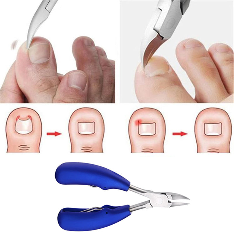 Zoe Precise & Ultra Sharp Nail Trimmer